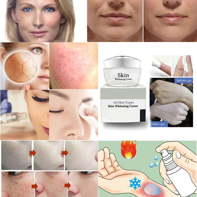 Hearan 1mg/vial CAS No.106096-92-8 Acidic Fibroblast Growth Factor Powder afgf