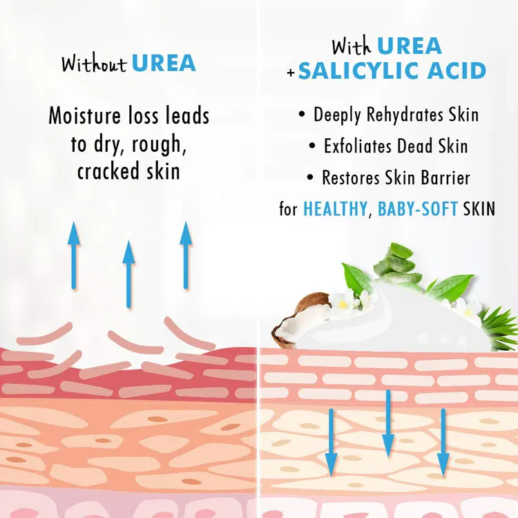 Private Label Urea 40% Foot Care Tea Tree Moisturiser Callus Remover Gel Skin Body Care Hand Cream  Foot Cream