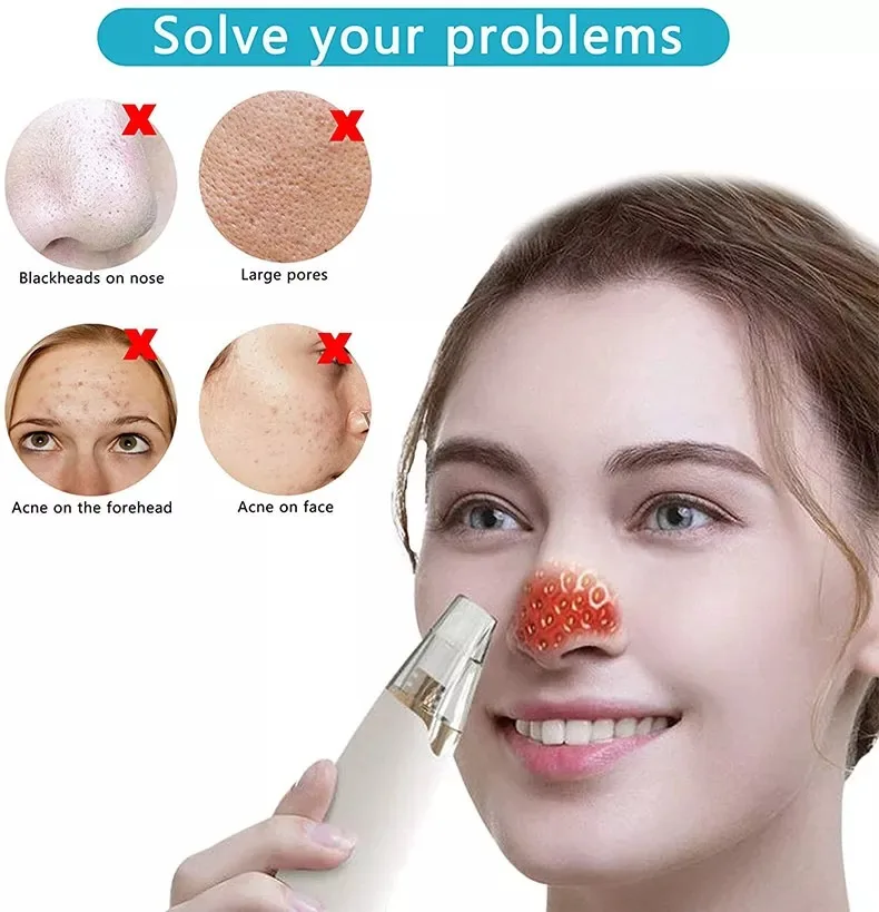 Home Portable Remove Skin Acne Pimple Deep Cleansing Face Care Treatment Products Remover For Sensitive Skin