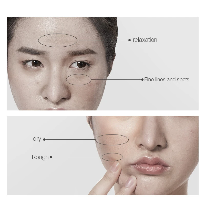 probiotics relief sheet mask Private Label OEM ODM Custom Logo skincare Korean Cosmetics wholesale skin care Facial mask