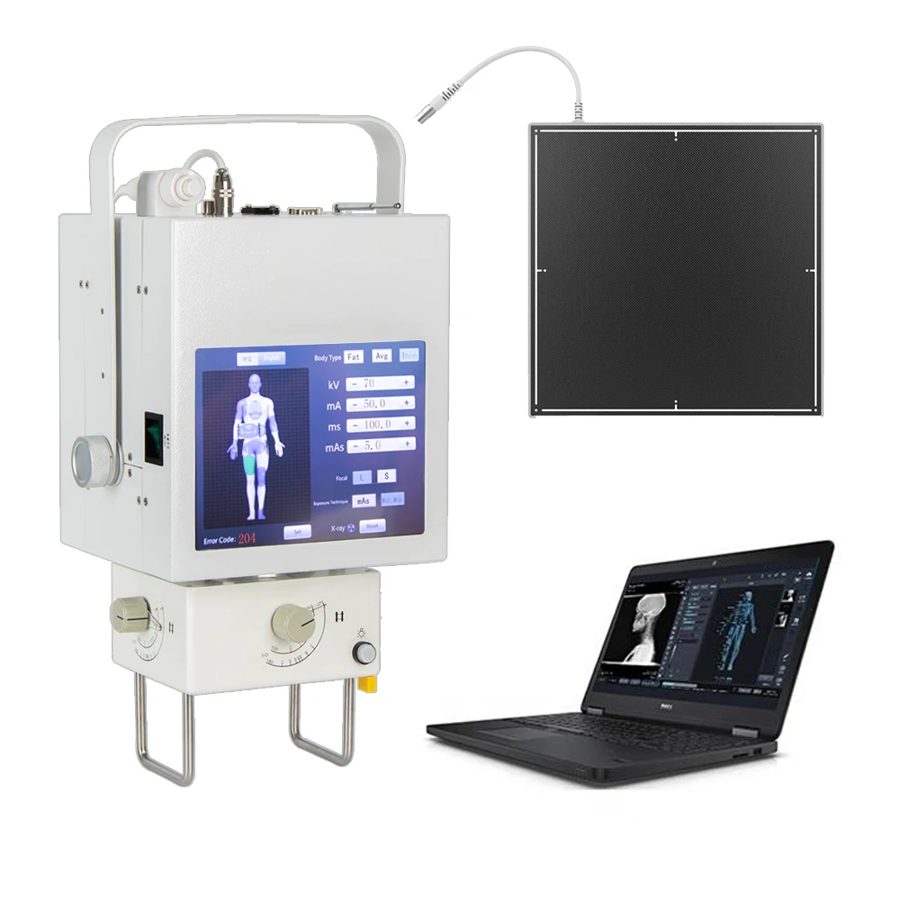 Radiology Equipment Medical Digital Portable X Ray Machine Price