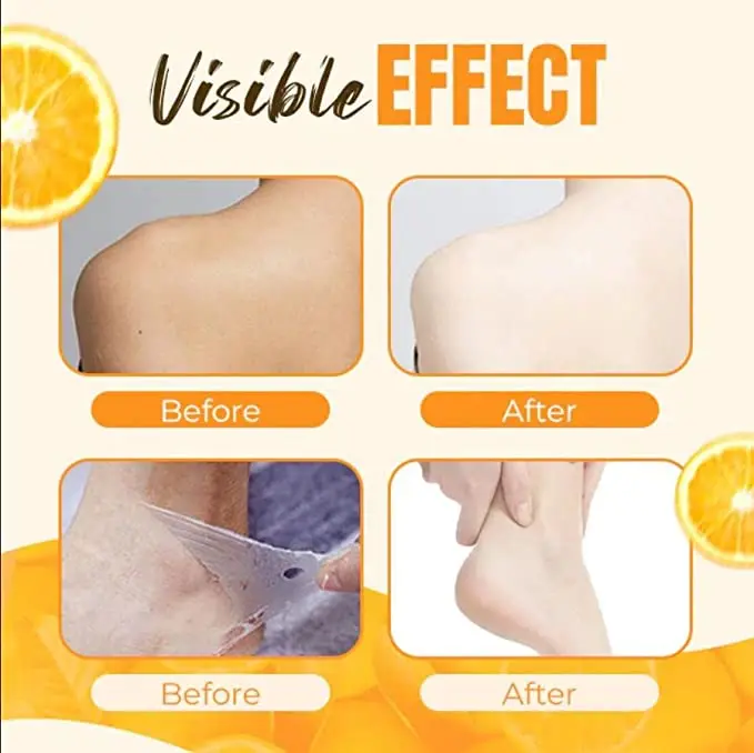 Tiktok 2022 Korean cosmetics Orange face body skin care dark knuckles Whitening remove Dead Skin beauty body peeling lotion gel