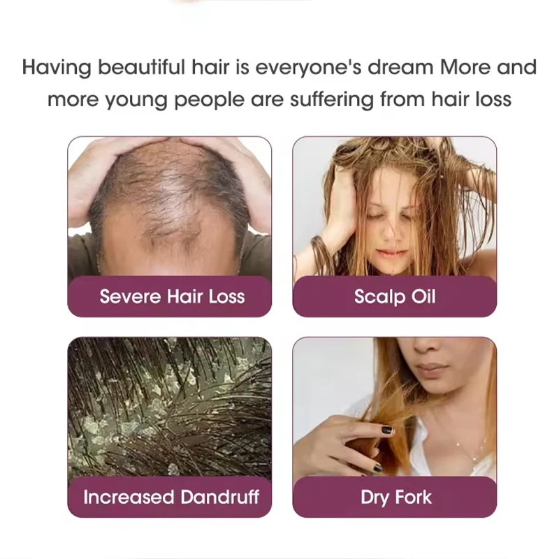 Factory hot selling hair care set 100% natural herbal red onion anti-hair loss repair nourishing shampoo and conditioner set