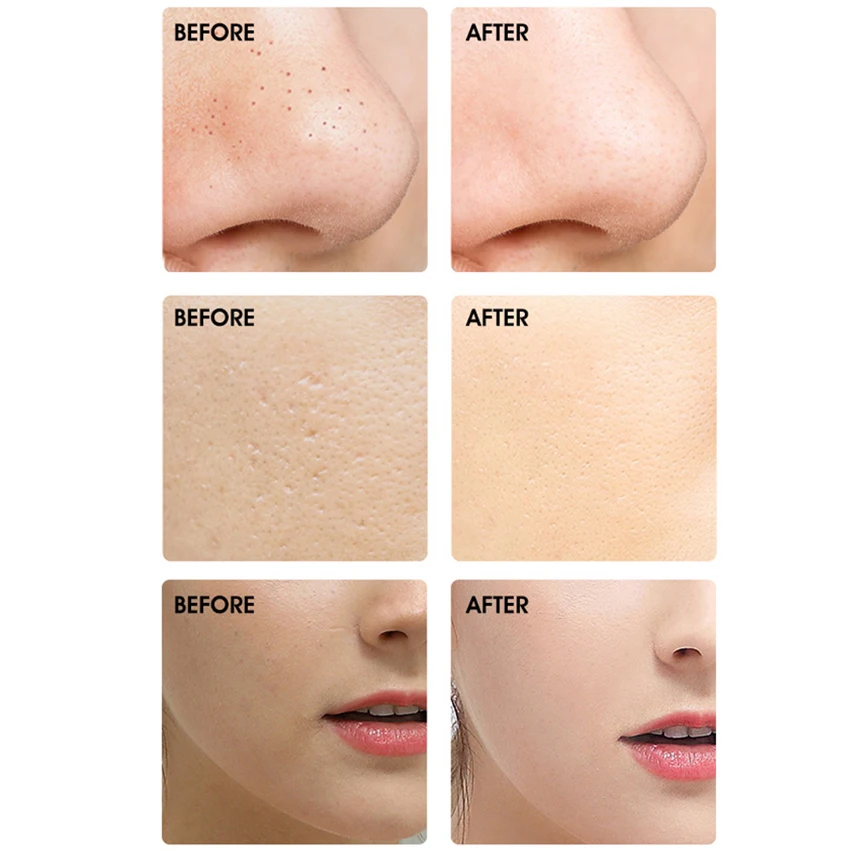 Factory Portable Ion Ultrasound Facial Spatula Face Peeling Ultrasonic Skin Scrubber Ultrasonic Face Scrubber