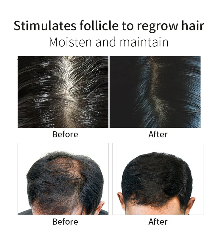 Best Hair Growth Serum for Women, Custom Natural Organic Hair Growth Serum