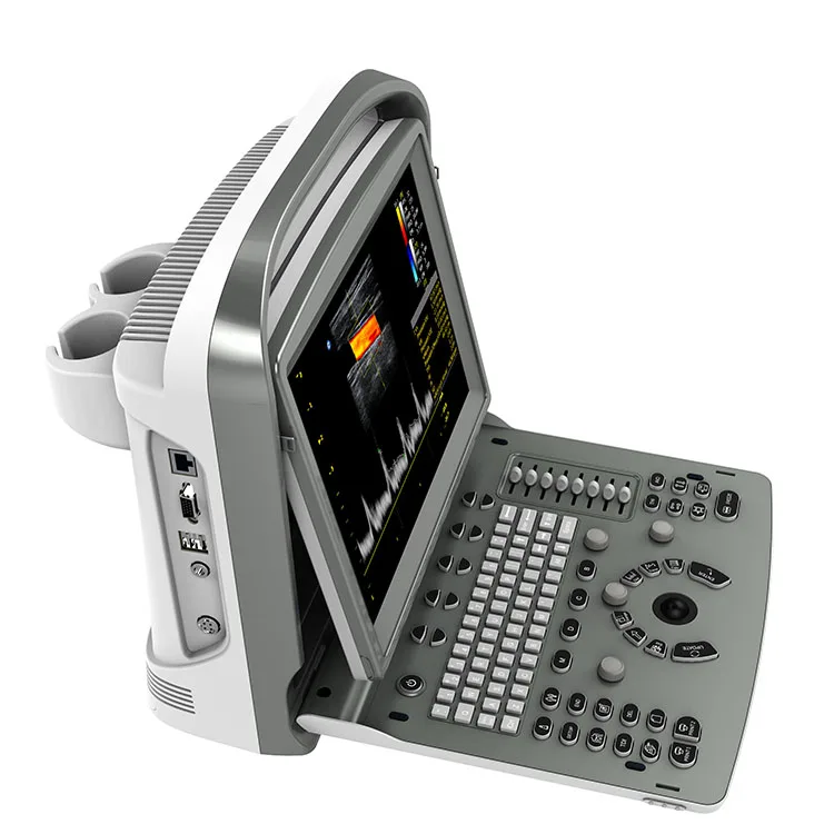 Chison ECO6 Promotion of the cheapest price Full digital ultrasound excellent 3D 4D color Doppler  ultrasound