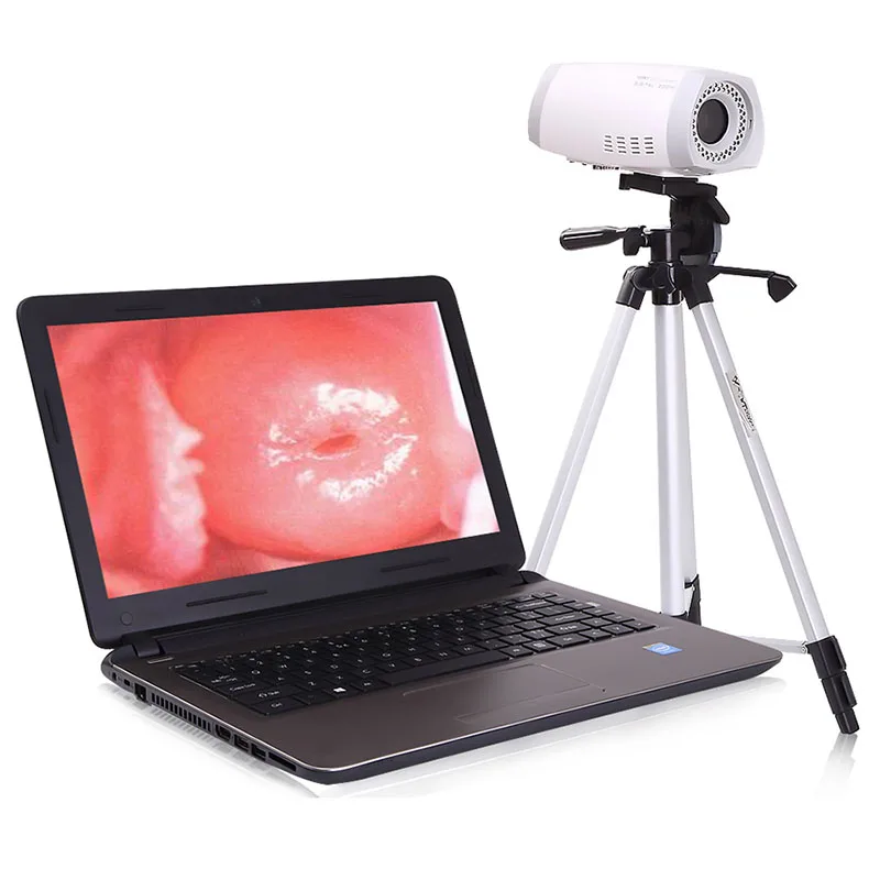 High quality medical electronics device colposcope portable medical colposcope with tripod