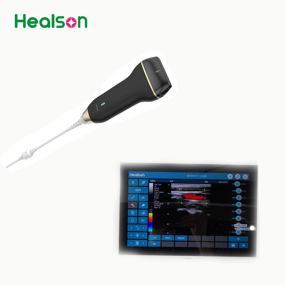  Самый дешевый USB микро ручной цветной допплер Healson C30L ультразвуковая система/машина/устройство/сканер