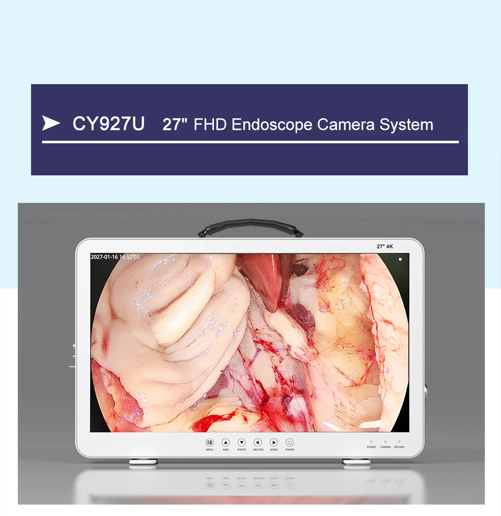 Cy927u 4k Veterinary 4 In 1 Medical All In One Full Hd Endoscopy Camera With 27/24/22/19 Inch Medical Endoscopy Monitor