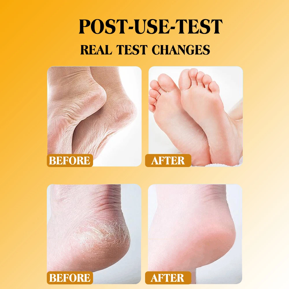 Private Label Dear She Whitening Organic Honey Essence Foot Heel Cream Moisturizing Softens Calluses Repairing Nourishing Skin