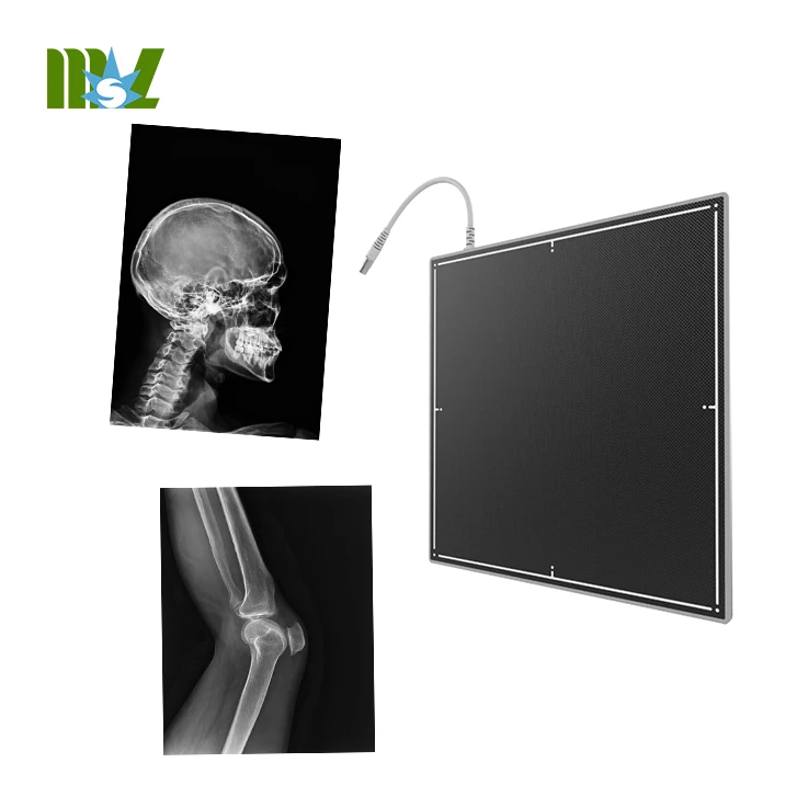 CareRay бренд Китай завод Оптовая 14x17 дюймов беспроводной цифровой рентгеновский плоский панельный детектор для человека или ветеринарный MSLCV01
