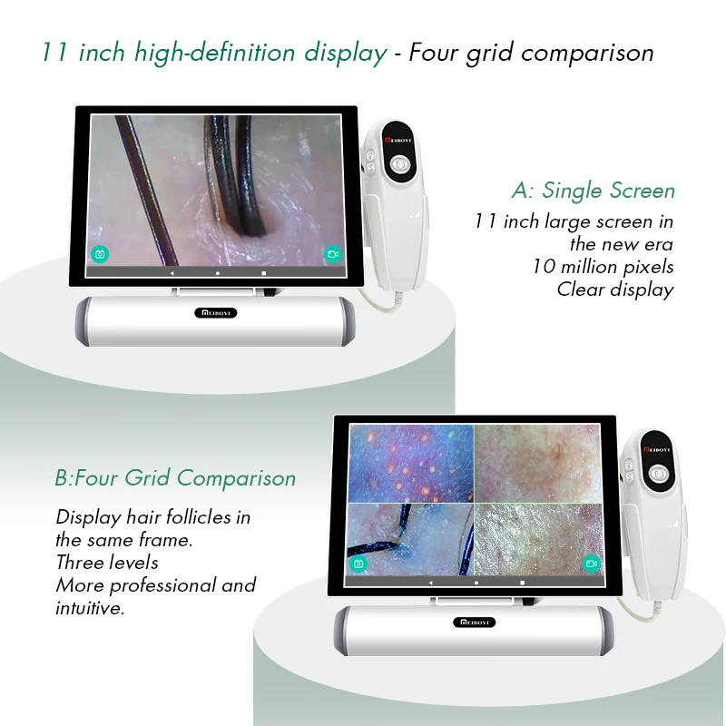 Meiboyi 2024 products smart HD touch screen hair detector analyzer scalp camera skin analyzer Head analysis machine Beautys