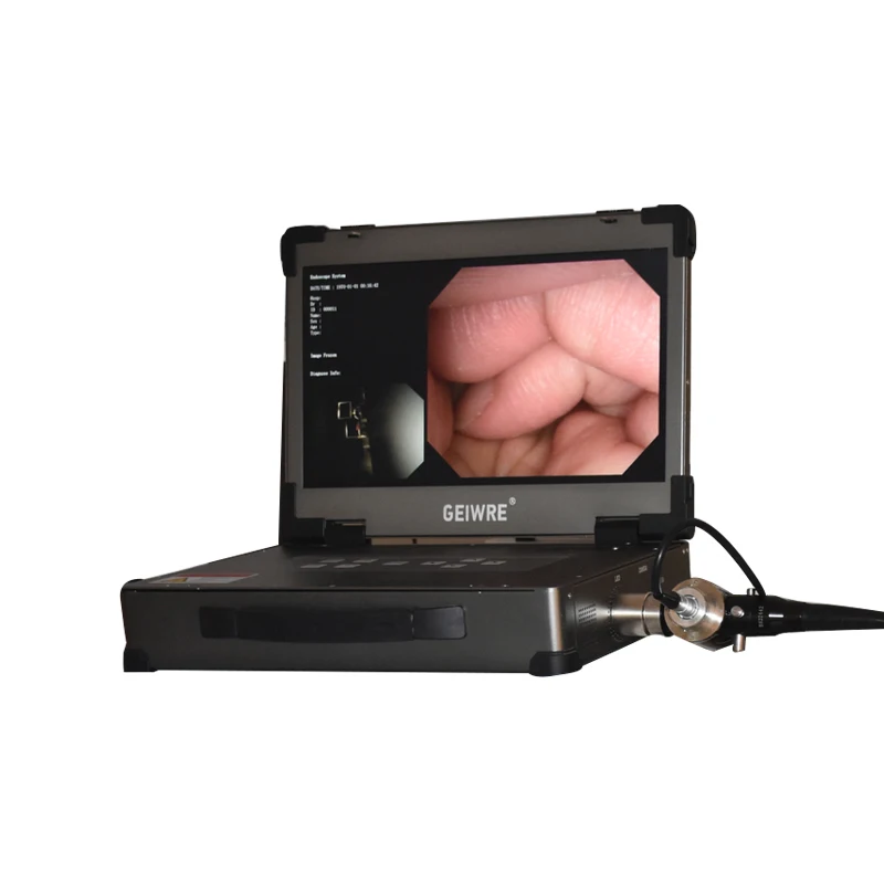 Portable USB/Tap C Endoscope System Electric Medical Equipment Video Ureteroscope for Surgical Instruments