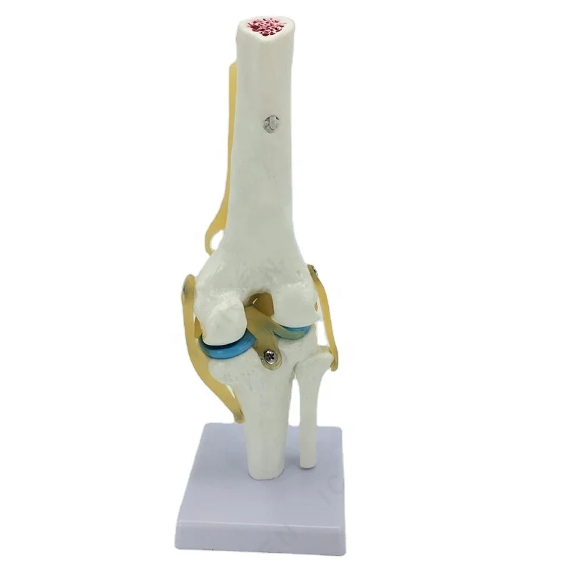 IN-M15 Plastic Elbow Joint With Ligaments,Model Of Human Knee Joint,Elbow Joint Skeleton Model