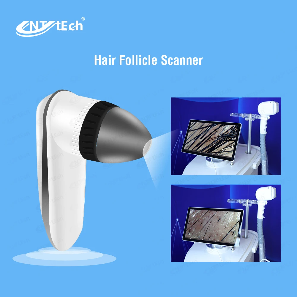 New design beauty salon super equipment professional vertical diode laser 2000w 808 dioda laser hair removing