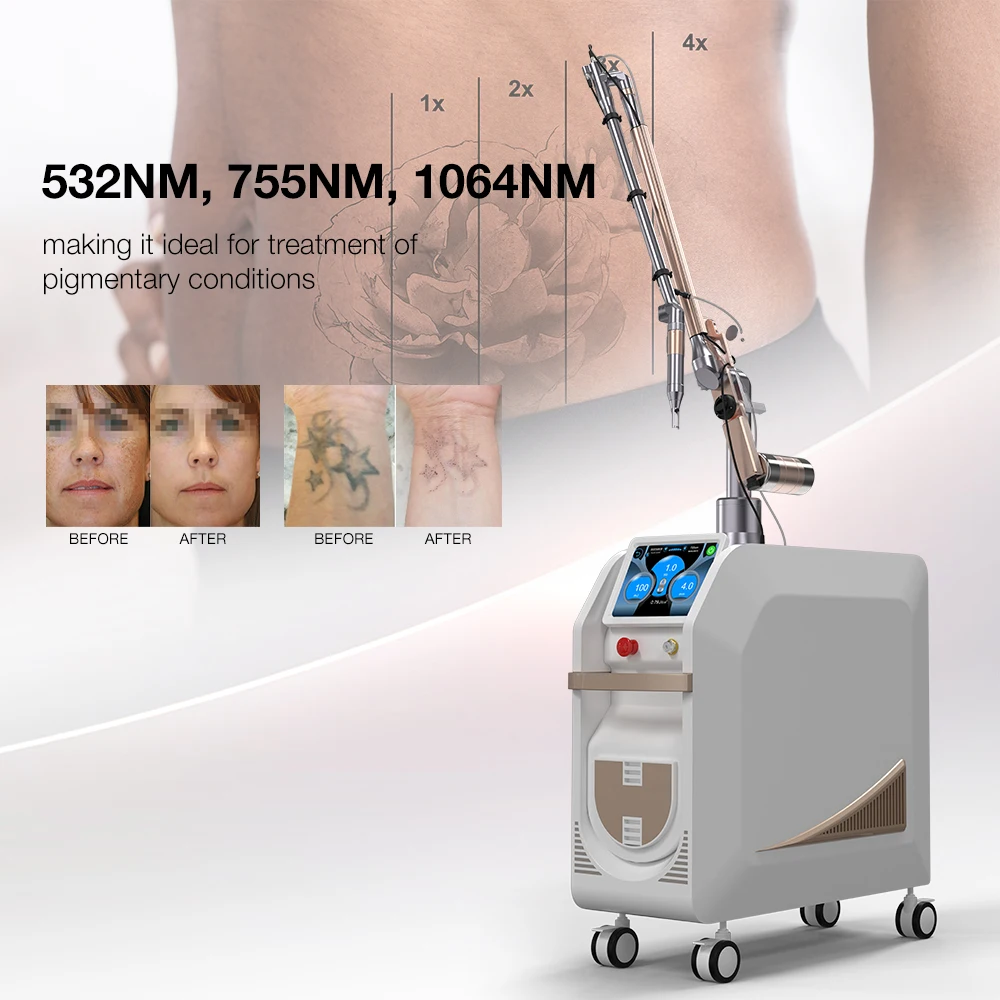 Picoking EL900 532Nm 755Nm 1320Nm 1064Nm Nd Yag Laser Picosecond Tattoo Removal Machine For Sale