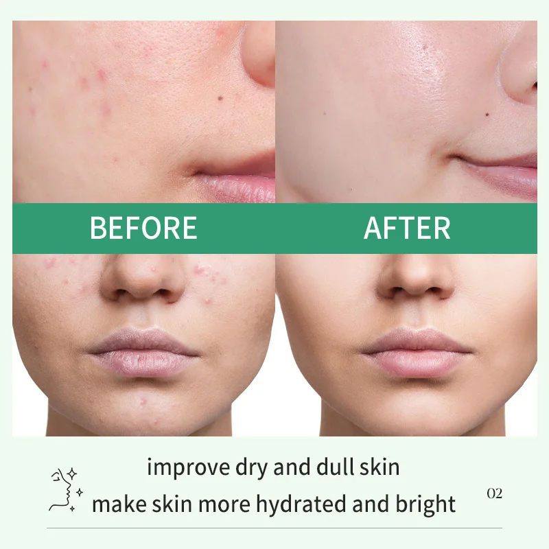 Squalane Jojoba Oil Nourishing Glow Massage Face Oil Certified Organic Anti Aging Hydrating Skin Care Face Oil For Gua Sha