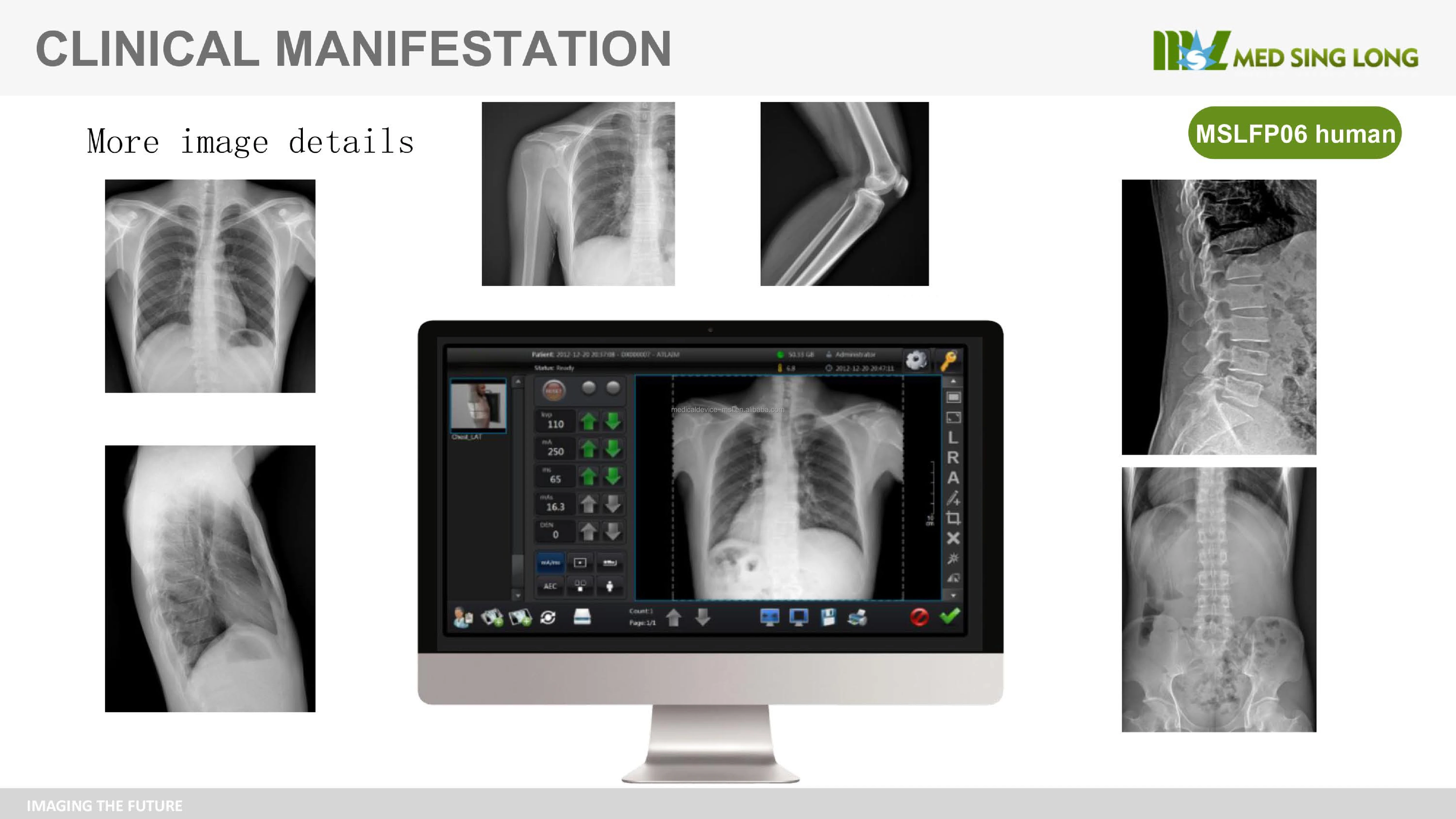 Hot selling Flat Panel X ray flat Panel Wireless 1717 Flat Panel Detector For Human/veterinary Use