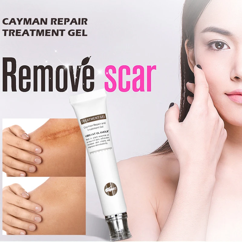 VIBRANT GLAMOUR Crocodile Scar repair Gel Liquid Female Regular Size Removal Scar Hyperplasia Removal Bruises scar repair Gel