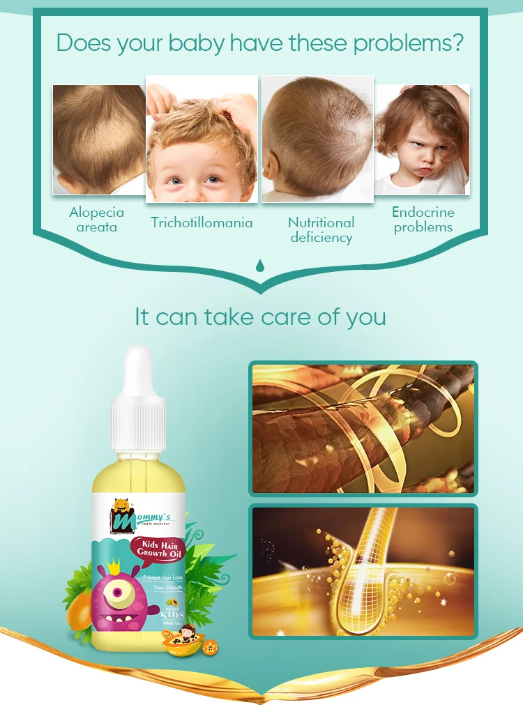 Mommy'S Little Monster Sultfate Free Cruetly Free Kids Baby Hair Growth Oil For Moisture And Nourish Scalp