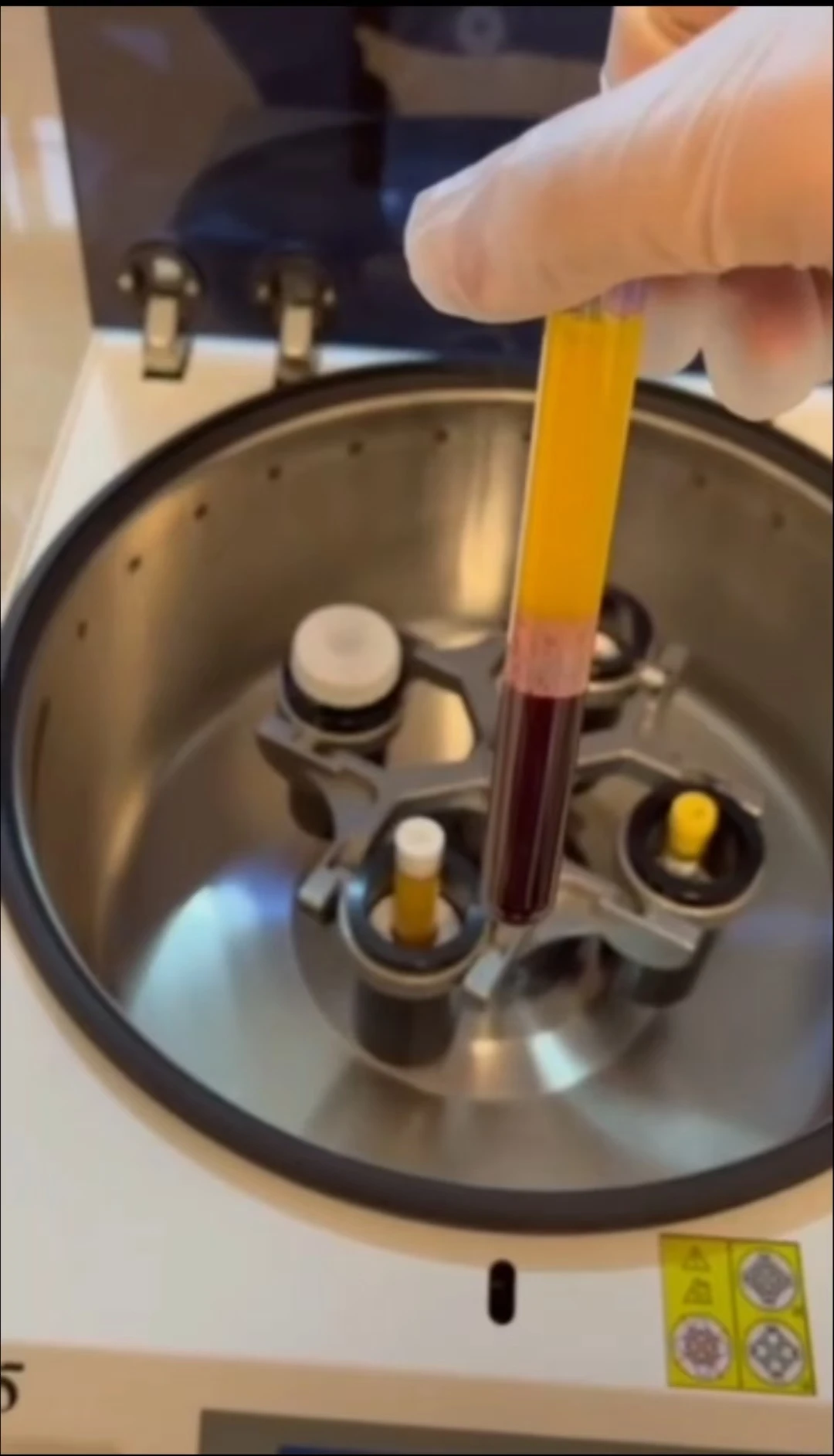 Hot Sell Cosmetic Clinical 12ml Blue Blood PRP Tube Sodium Citrate Gel PRP Injection for Face v Lifting Skin Care Knee joint