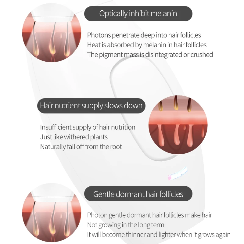 Portable at home  IPL SHR  laser hair removal machine ipl hair removal certified handset for men