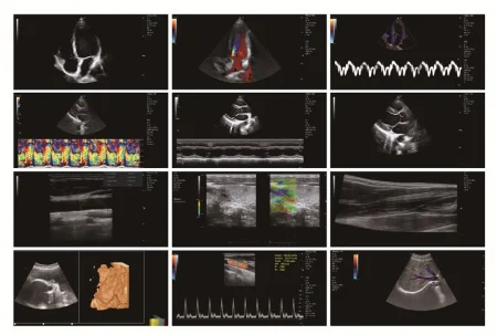 Мобильный телефон ультразвуковой сканер Vet цена D Ультразвуковой новинка