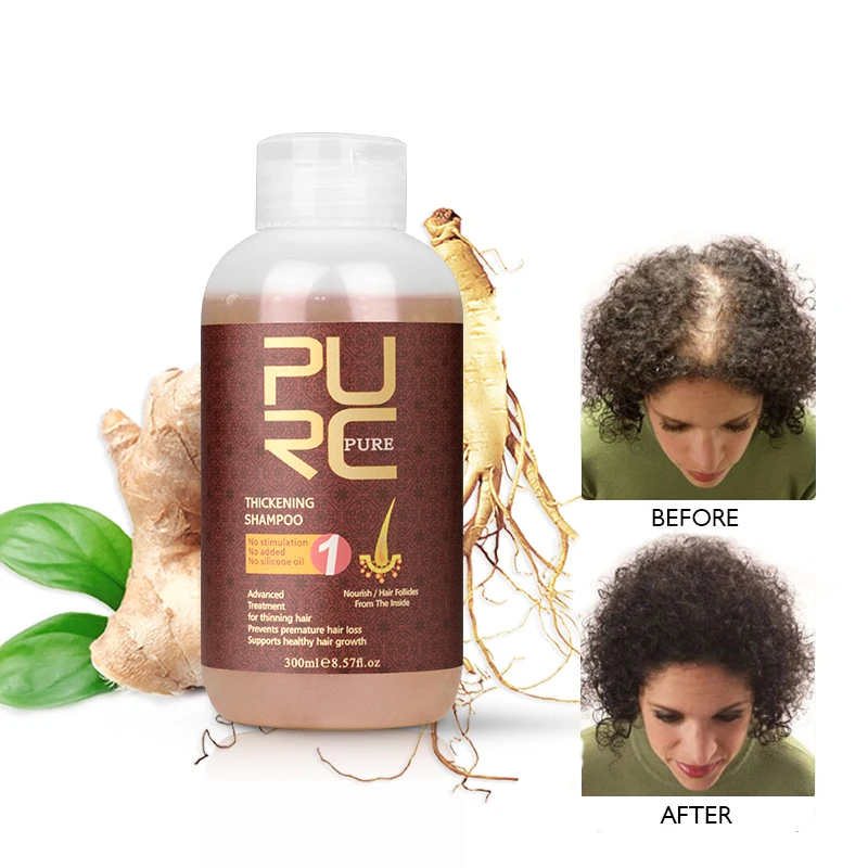 
China Manufacture natural organic ginger hair anti loss growth treatments shampoo and conditioner for men women hair fall  (60457054279)