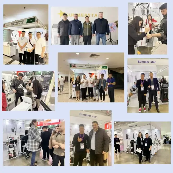 SummerStar 2024 Latest Production Hair Removal 808nm Diode Laser In Commercial