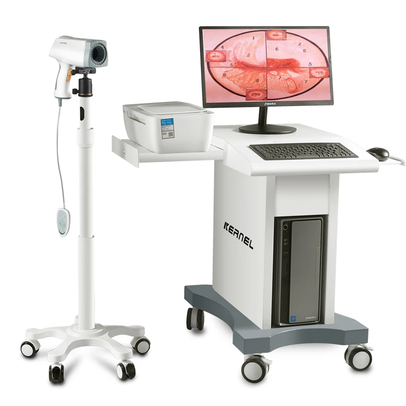 High-End Medical Colposcopy Machine Electronnic Digital Video Colposcope for Gynecology Portable Digital Colposcope Colposcopy