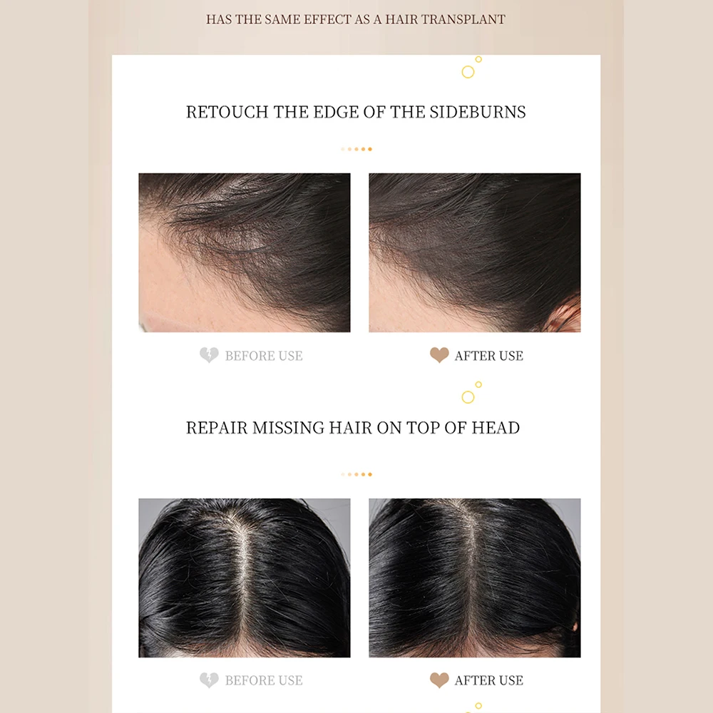 Hairline Powder Instantly Conceals Hair Loss Root Touch Up Hair Powder for Women & Men Thinning Hair(Black) -739146