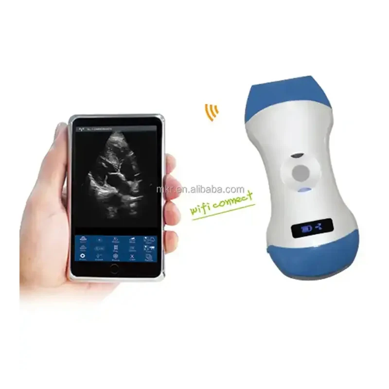 Lightweight Hospital Diagnostic Equipment Linear Convex Laptop Wireless Handheld Portable Ultrasound Scanner