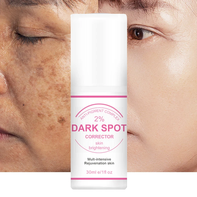 private label Best Korean Whitening Crean Niacinamide Fast Lightening Body Underarm Permanent Skin Whitening Dark Spot Corrector