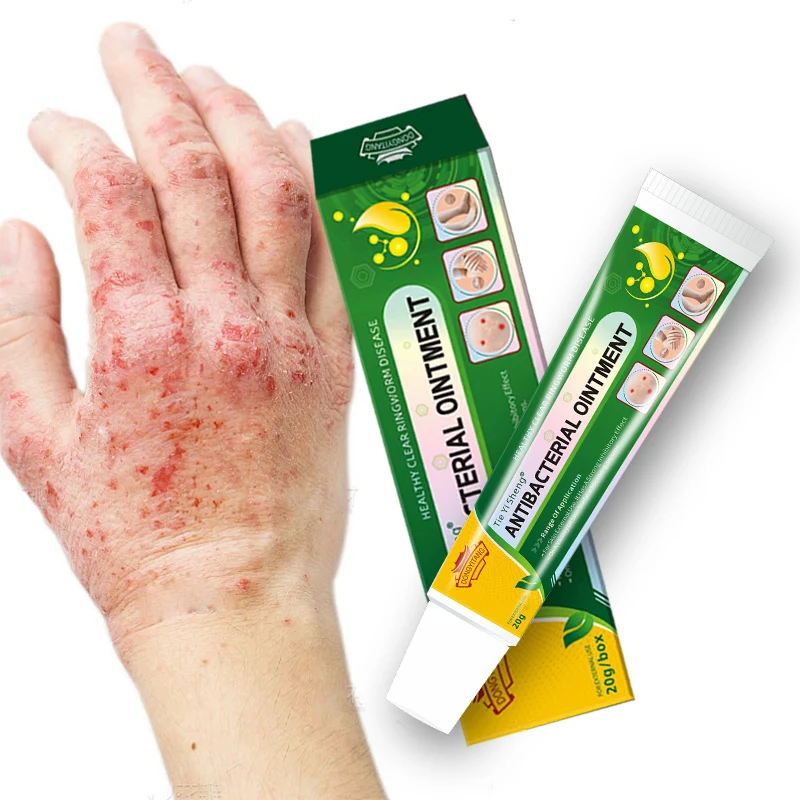 Custom Logo Herbal Green Healthy Skin Care Cream Fungal Infection cream