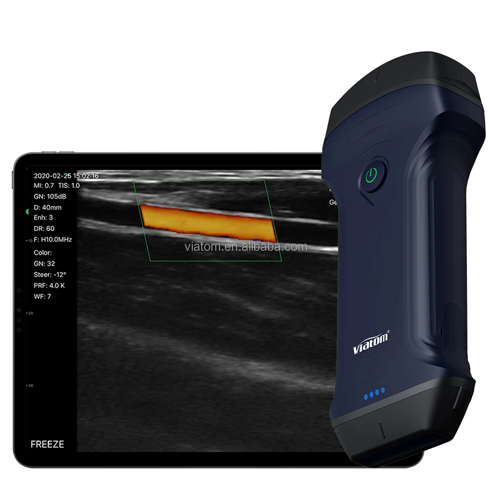 Viatom Wireless Ultrasound Scanner Portable Cooling Coating Technology Convex Cardiac Linear Medical Handheld Ultrasound Probe