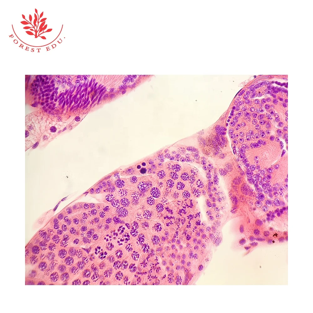 Biological Teaching Slide Specimen Of Locust Spermatocyte Meiosis Mounted Microscope Of Grasshopper Spermatocyte
