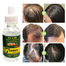 Private Label Natural Organic Vegan Treatment for Bald Hair Serum Wholesale Herbal Anti Hair Loss Boosting Hair Growth Oil