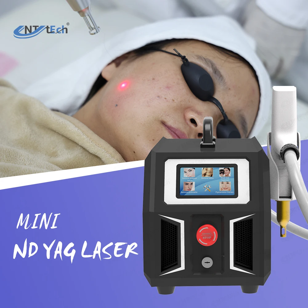 Portable tattoo removal carbon peeling nd yag laser machine q switched erase remove color tattoo