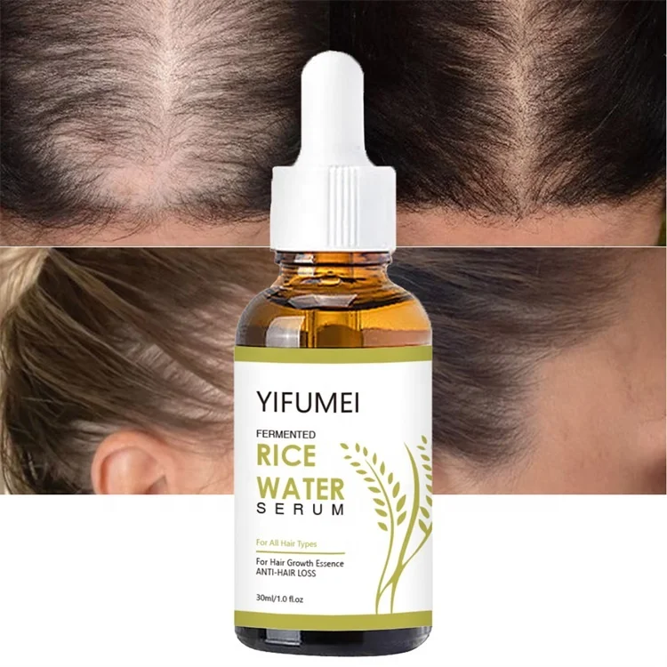 Private Label Rice Wheat Germ Bald Alopecia Hair Growth Regrowth Oil For Hair Treatment