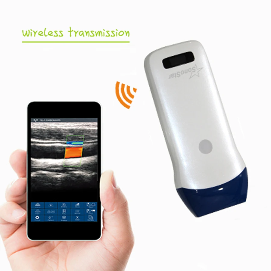 L5 Linear Color Doppler Sonostar Pocket Ultrasound Wireless Probe