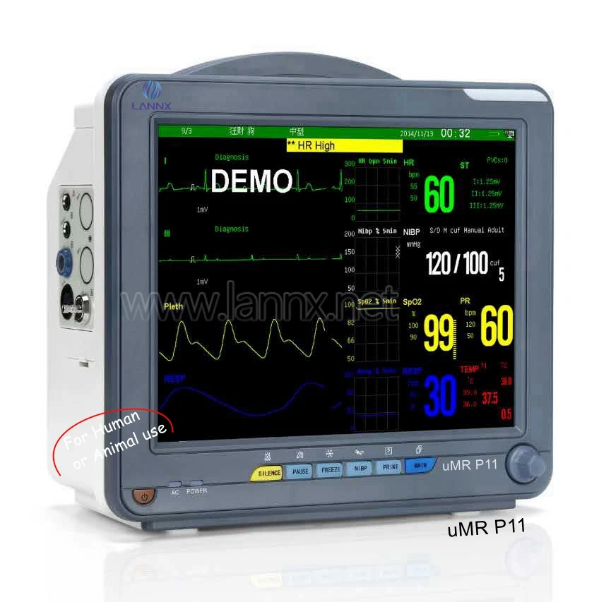 LANNX uMR P11 High Quality hospital animal and Human use Patient Monitor big screen Handheld Vital Signs Monitoring Equipment