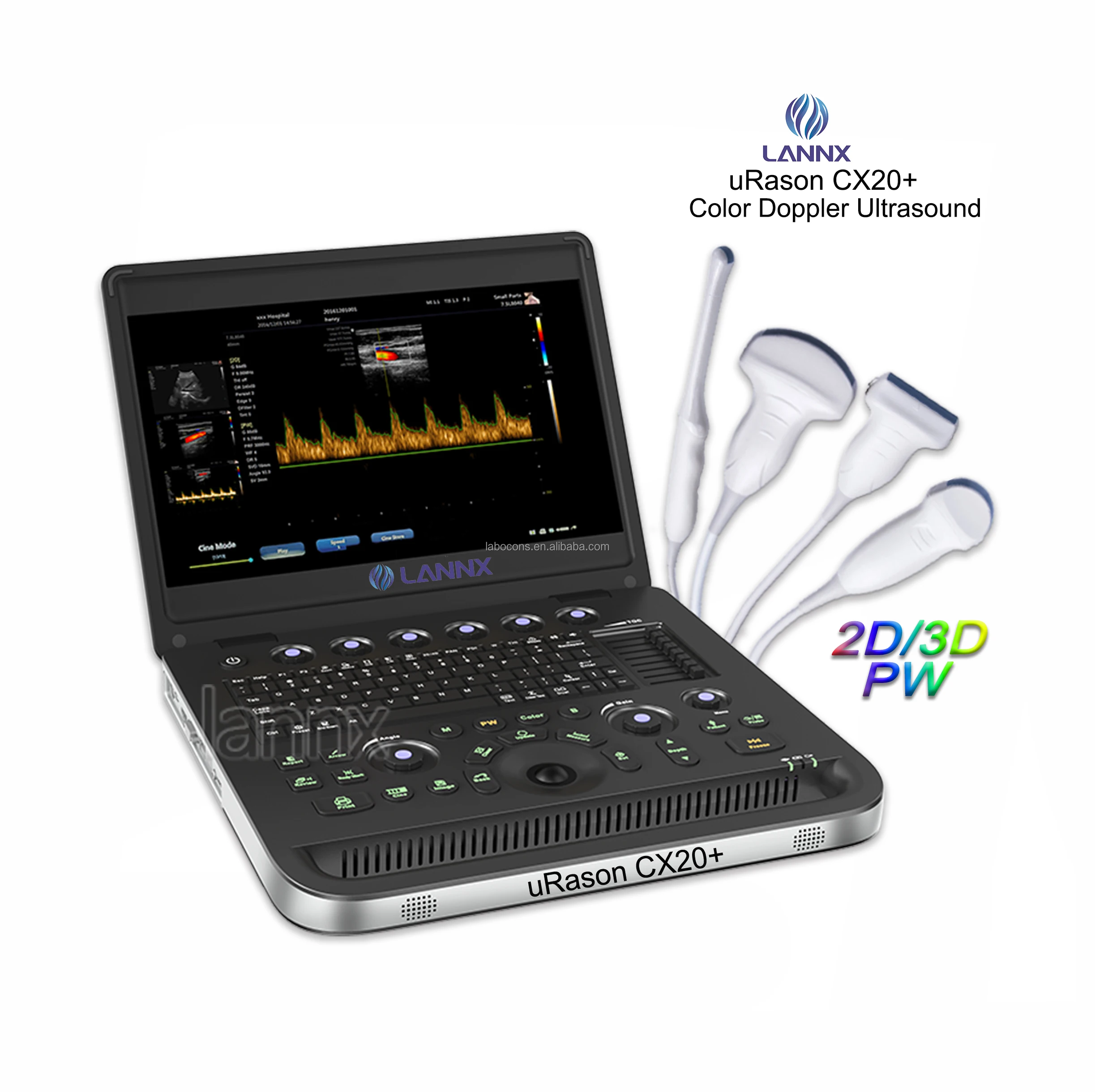 LANNX uRason CX20+ Multipurpose Color Doppler Ultrasound Portable Digital Ultrasonido Laptop 2D 3D ultrasonic Scanner