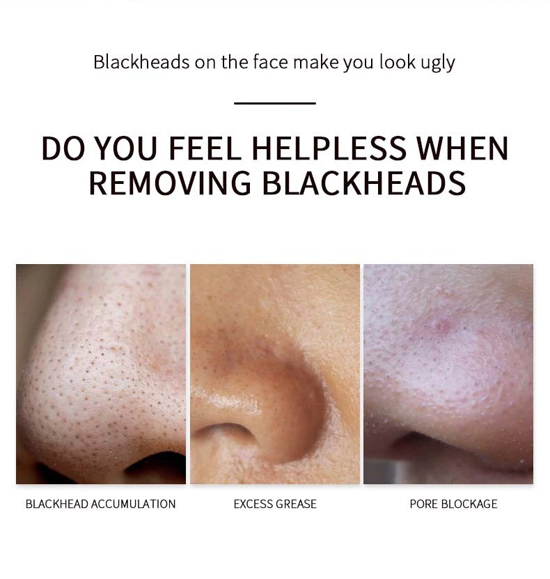 Wholesale Blackhead Remover Nose Pore Strips For Black Head Remover Mask For Face Puntos Negros 30g+60pcs Paper