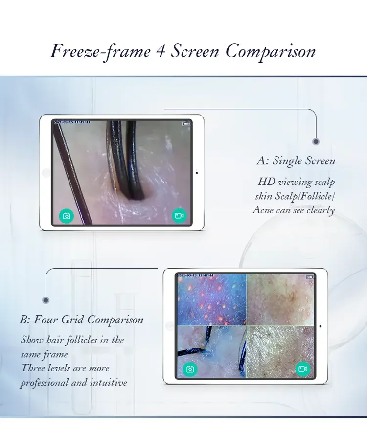 Professional 5G WiFi Wireless Home Use Scalp Skin Analyzer Portable Four-Spectrum Detector