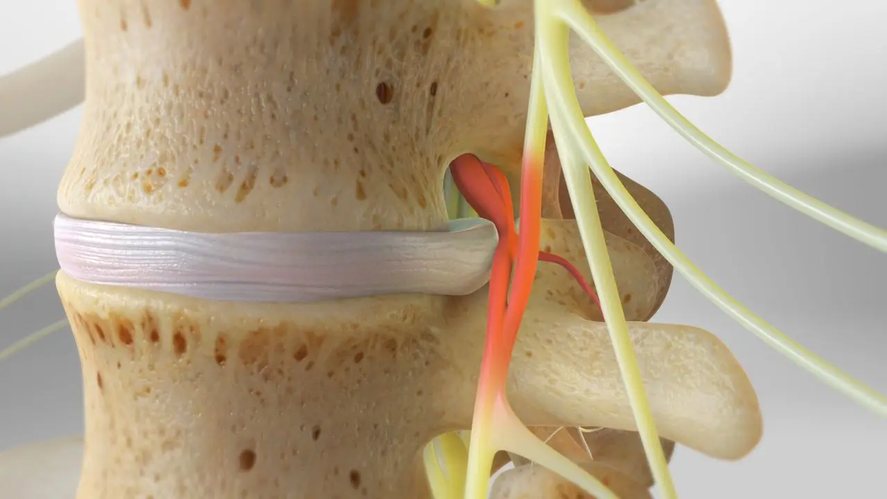 New diode surgical  pldd laser surgery equipment for numbnesssciatica laseev diode laser 980nm+1470nm