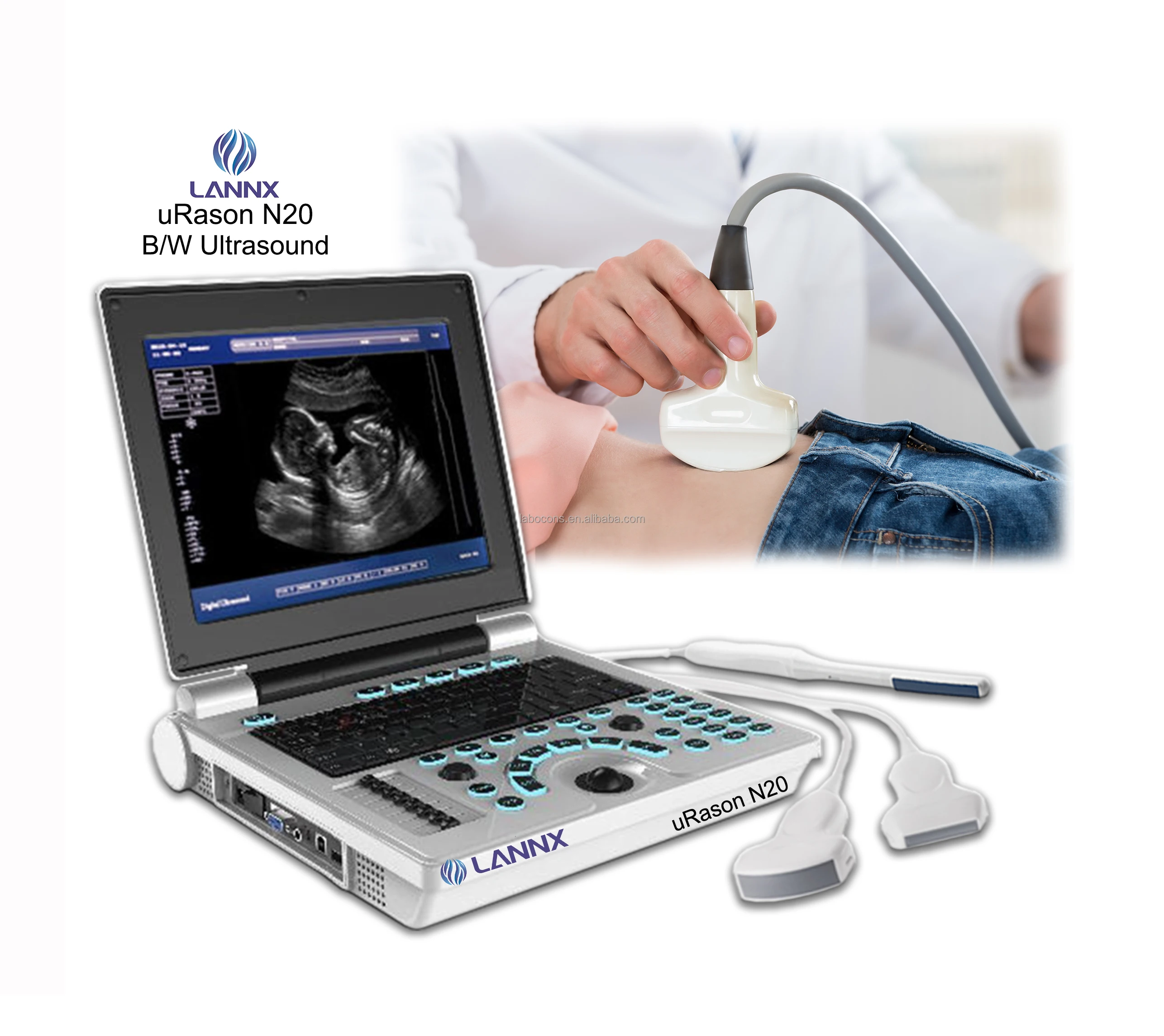 LANNX URason N20 Well Designed Black and White Portable Ultrasound Scanner Ecografia Portatil Laptop Digital USG Diagnostic