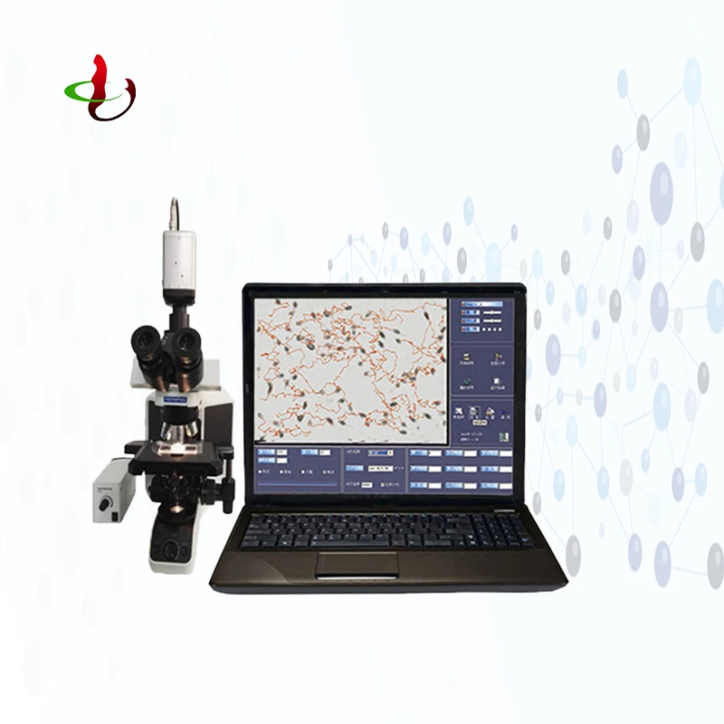 Automatic sperm analyzer/ medical male semen quality measurement equipment