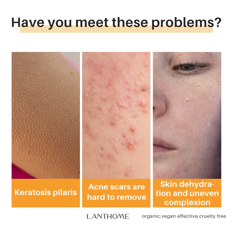 Beauty Natural Collagen Acne Dark Spot Remover Skin Whitening Lightening Bathing Soap for Face Hand Body Washing