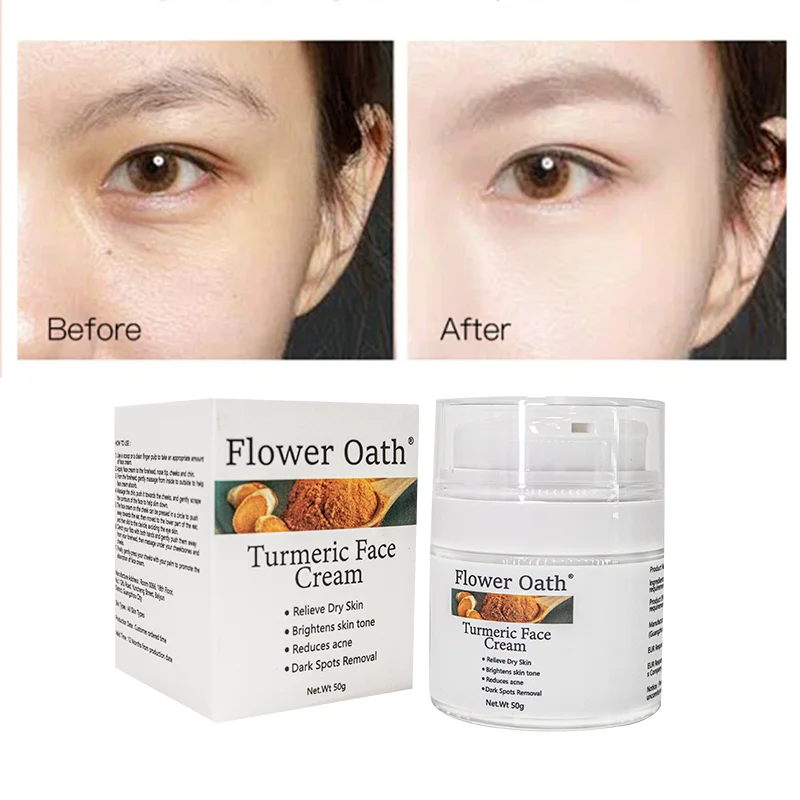 Dark Spot Corrector Remover Anti Aging Pigmentation Skin Care Brightening Whitening Lightening Moisturizer Turmeric Face Cream