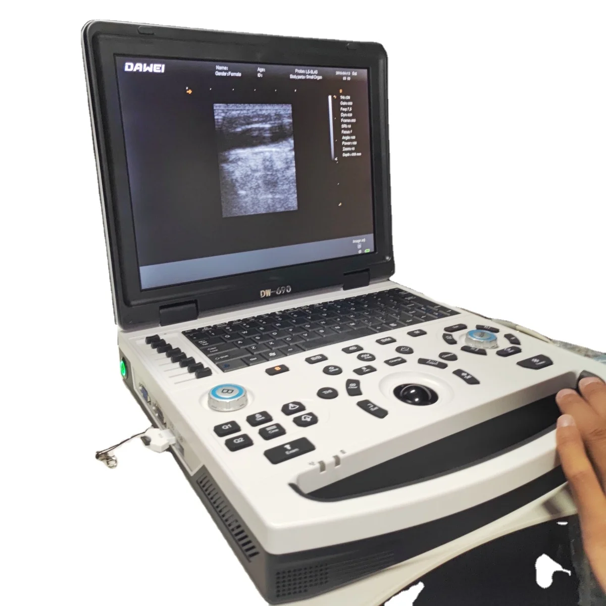 Windows System PC Based B/W  Medical Full Digital Ultra Sound Scan Machine Laptop Ultrasound Scanner
